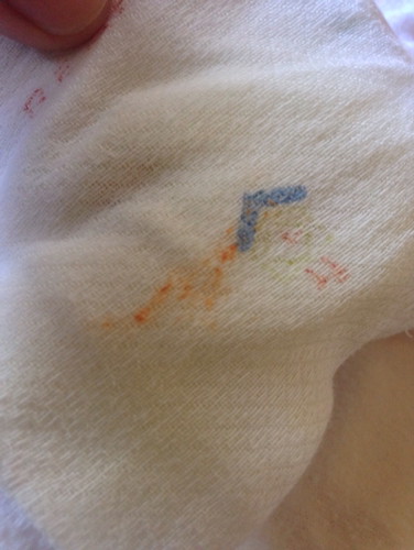 Orange discharge si baby help!!