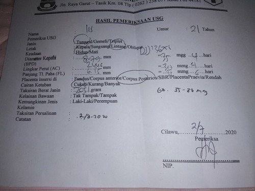 Posisi bayi Melintang