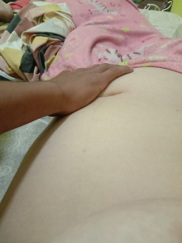17w5d