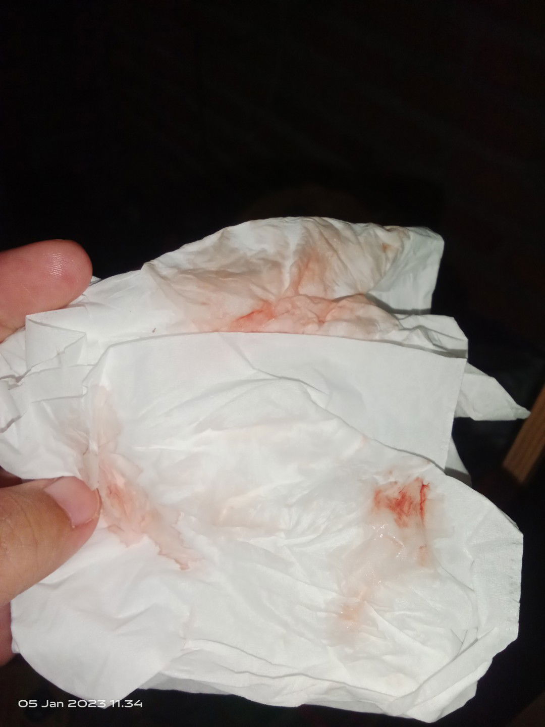 Hpl 9jan tdi udh keluar flek darah