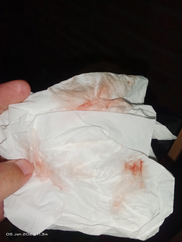 Hpl 9jan tdi udh keluar flek darah