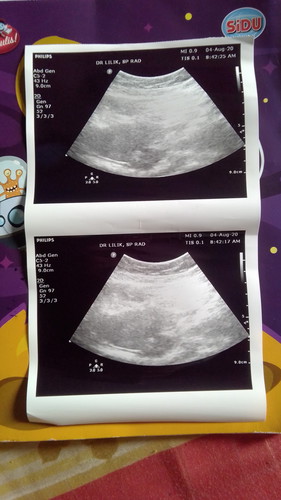 Bismillah Semoga Tidak PHP