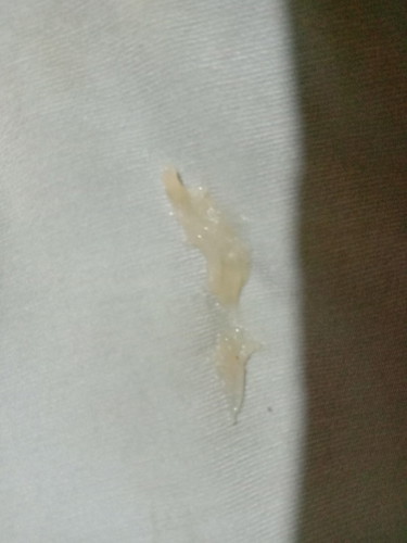 ขอความคิดเห็นค่ะ