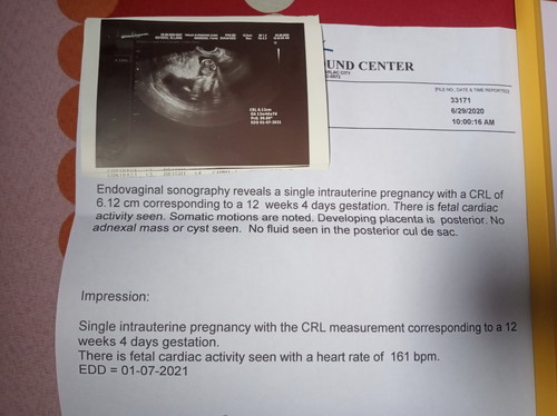 1st ultrasound