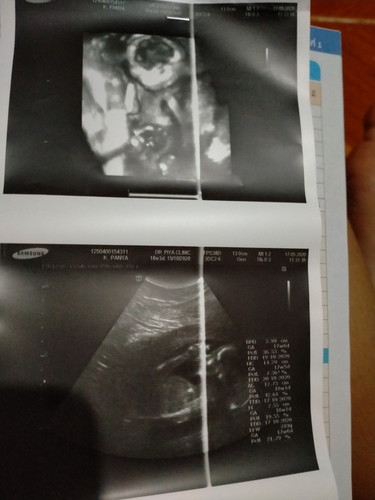 21w4d