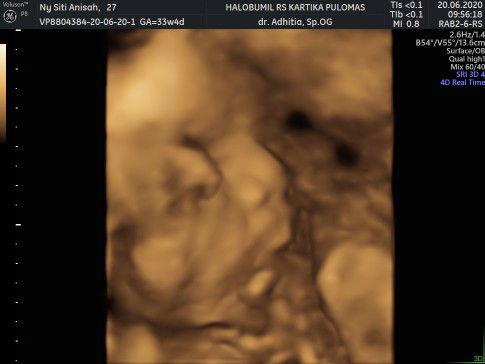 cara ampuh nambahin bbj