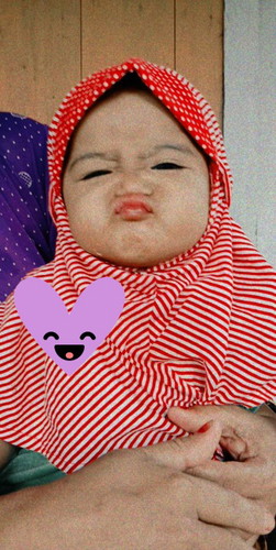 misal ya kan saya oprasai (SC) klo hamil lgi gmana