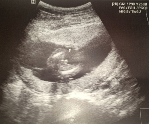 Baby's gender
