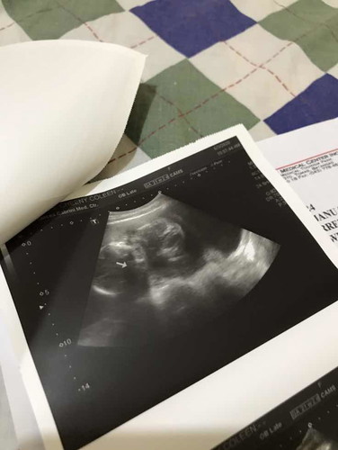 Suhi si baby 21 weeks.