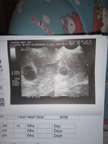 5weeks