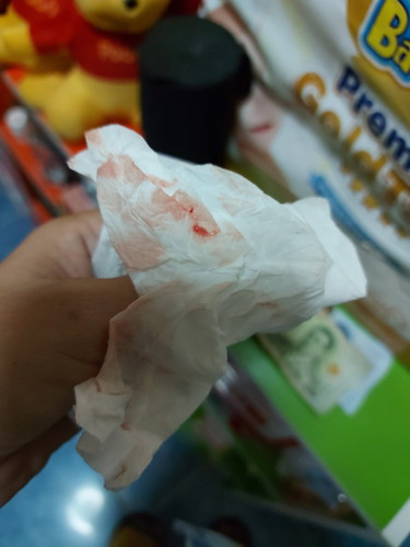 มูกเลือด