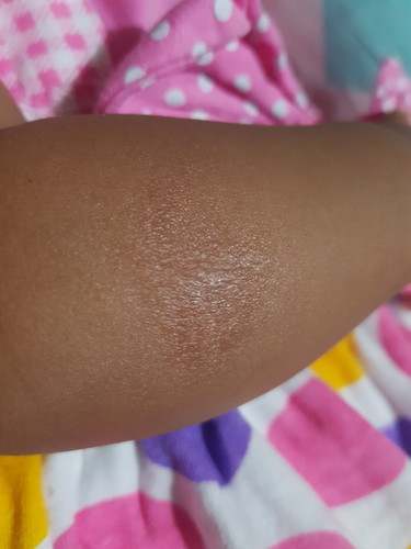 kulit