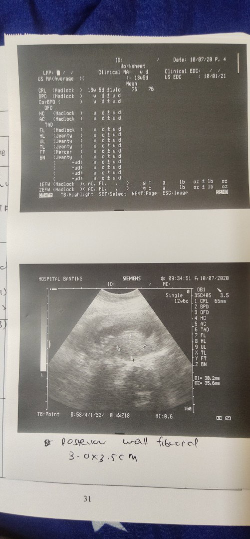 14 week
