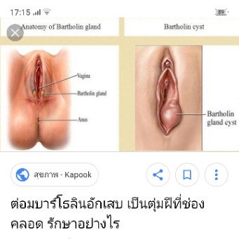 ??