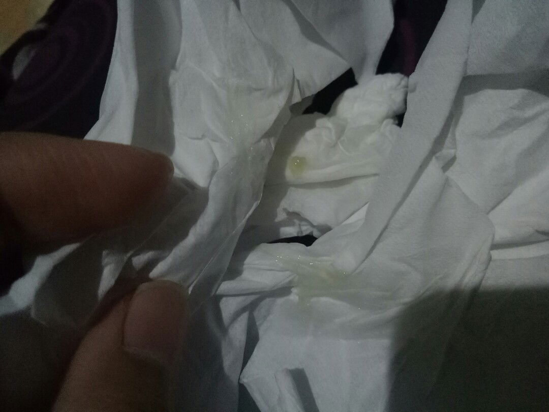 lendir hijau saat hamil muda
