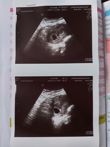 อัลตาซาว