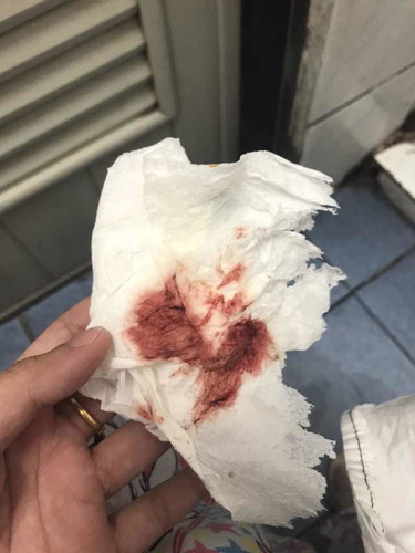 แท้งคุกคาม