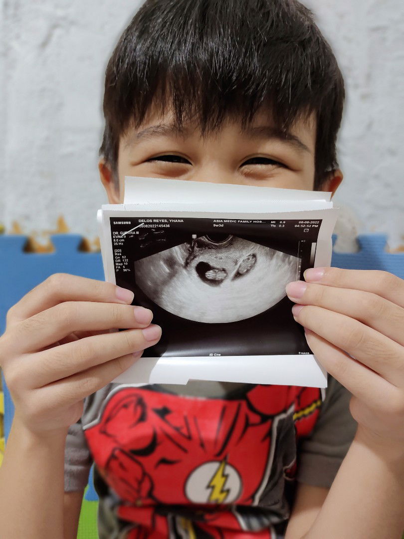 Yhana Kane De Los Reyes profile icon