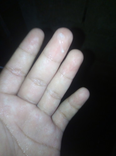 มันจะอันตรายไหมค่ะ
