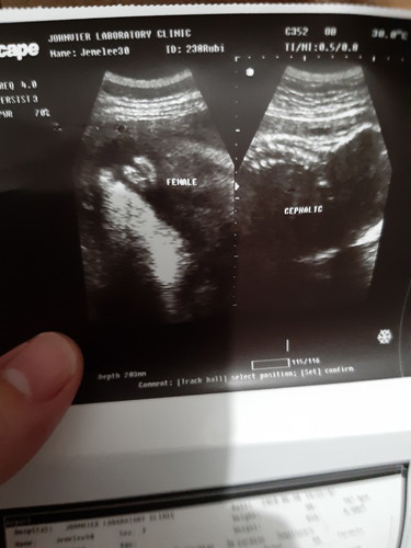 ultrasound
