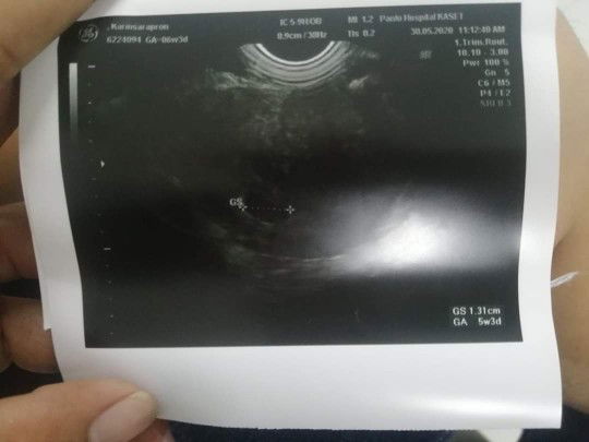 เจอถุงตั้งครรภ์แล้ว...ดีใจๆ