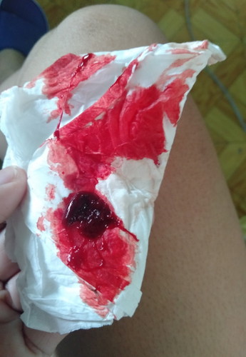 buong dugo