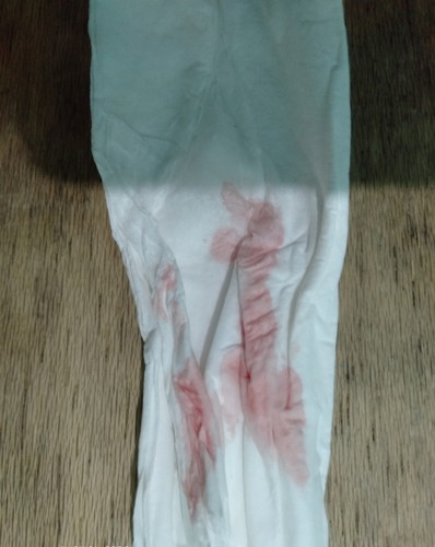 pinkish blood