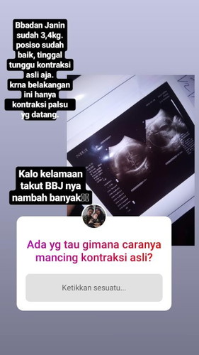 Seputar kehamilan