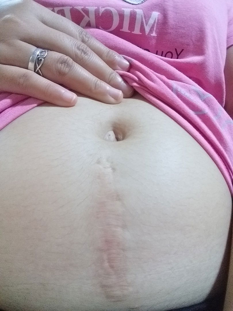 Past Operation Mark (CS or not)