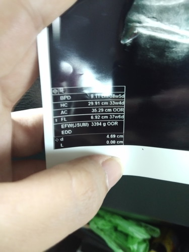 น้ำหนักลูก
