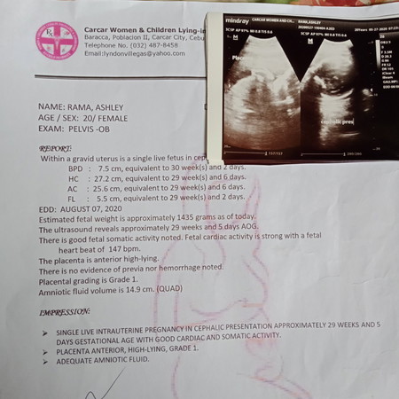 ultrasound result