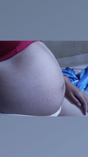 อายุครรภ์