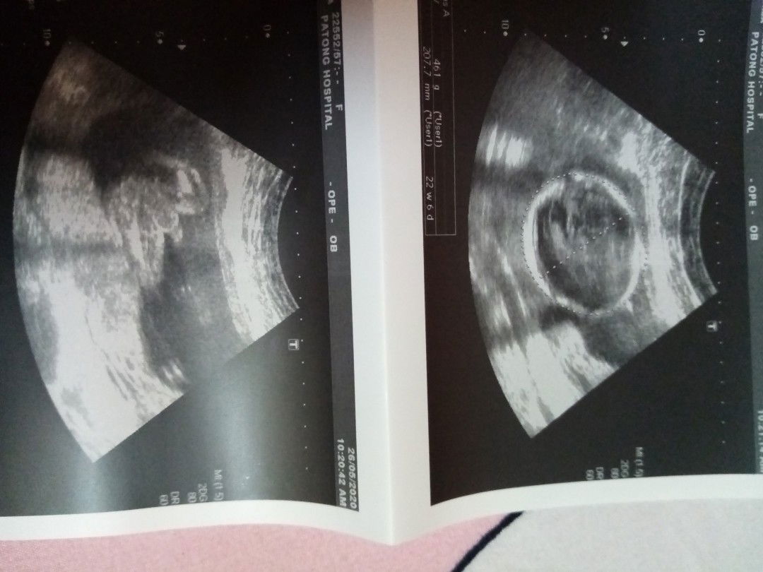 22week 5day ผู้ชายคะ​