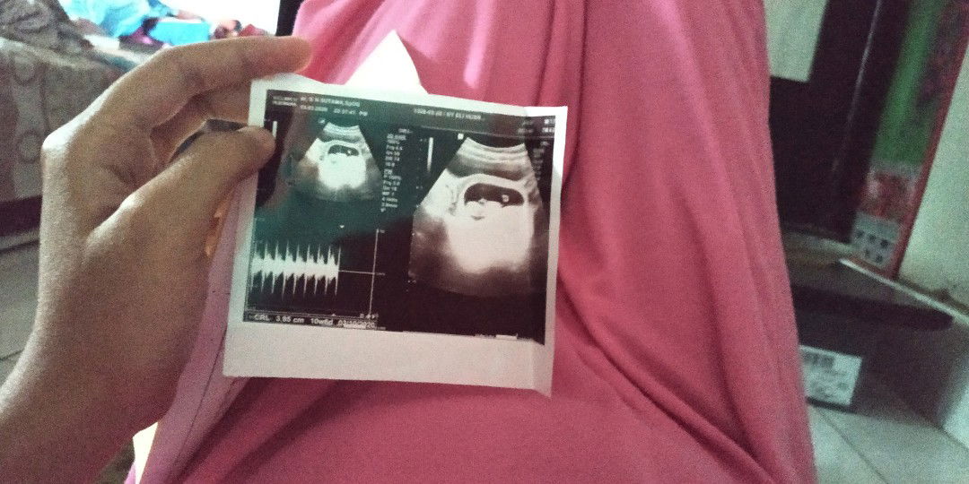 Eli Husrifani Ahyar profile icon