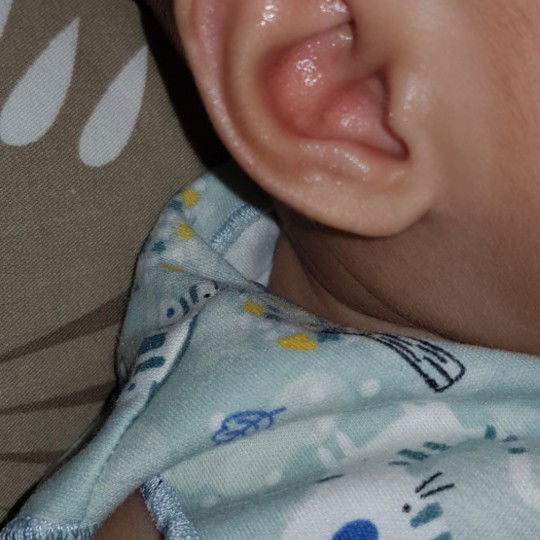 Kuping Merah Beruntusan