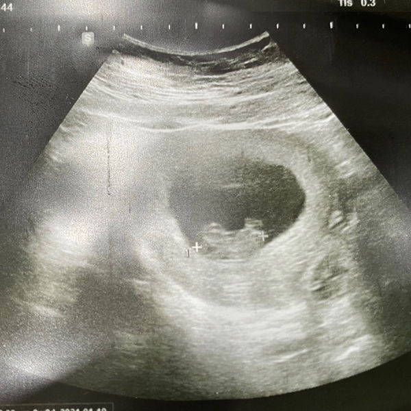 Ladiie N profile icon