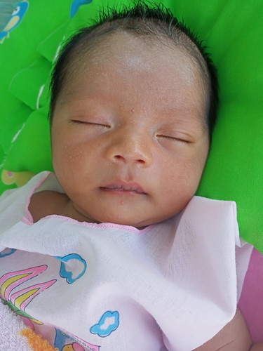 ถามเเม่ๆหน่อยค่ะลูกเราเป็นผดผื่นขึ้นเต็มหน้าเรยเป็นอันตรายมั้ยค่ะน้องเพิ่งได้10วัน