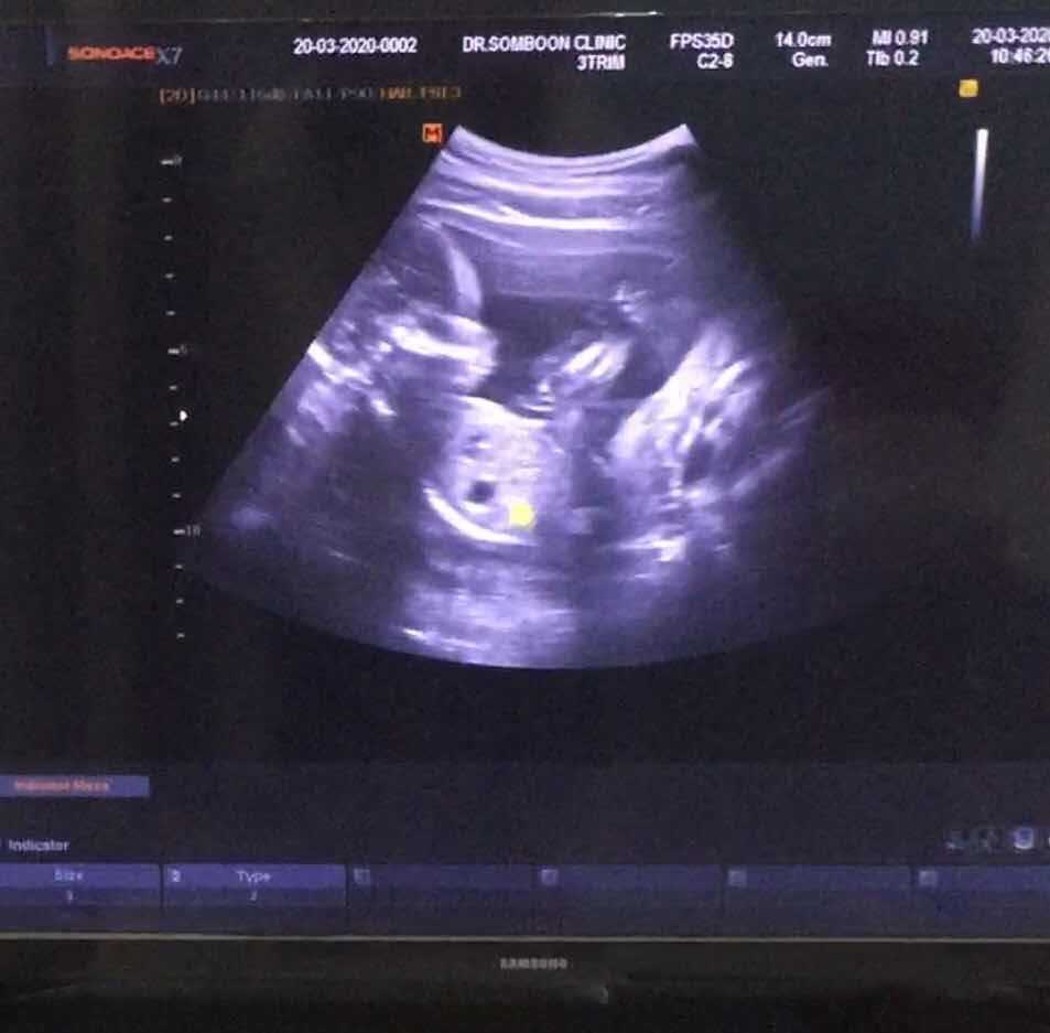 nong-August profile icon