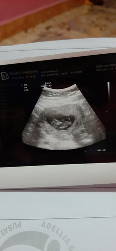 dari mana bisa tau jenis kelamin nya?