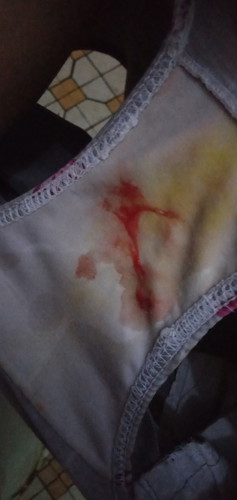 Blood discharge at 38 weeks ang 4 days