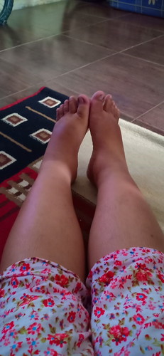 kaki bengkak