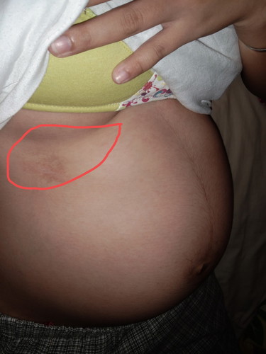 36 weeks and 3 days
