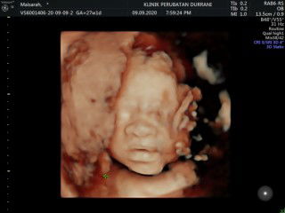 Nurul Maisarah profile icon