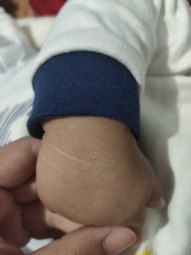 Baby skin