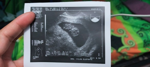 BABY' IMAGE