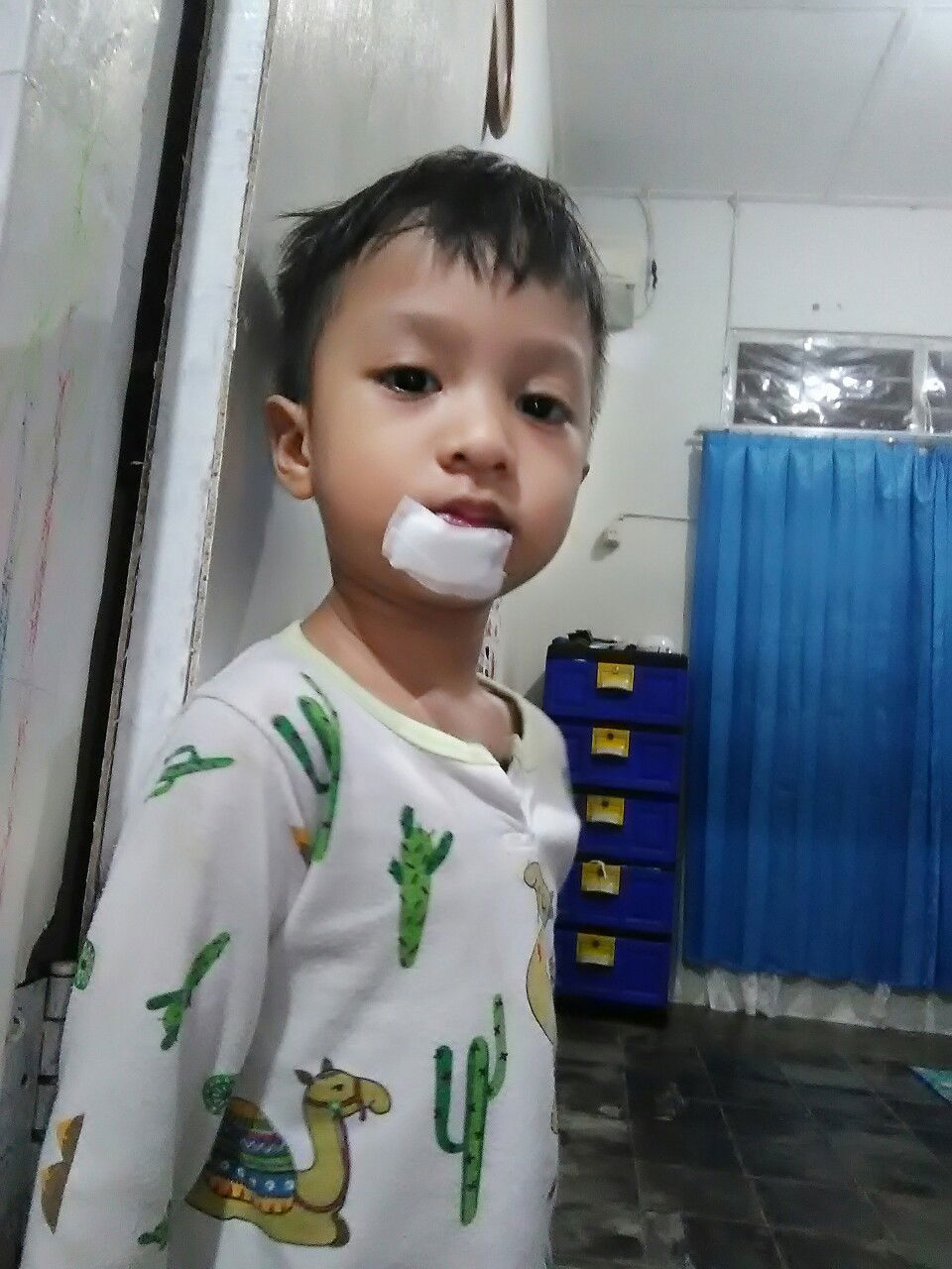 ada kah yg punya pengalaman anak jatuh seperti anak saya?