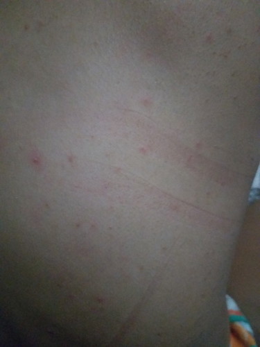 normal lang po ba to sa buntis