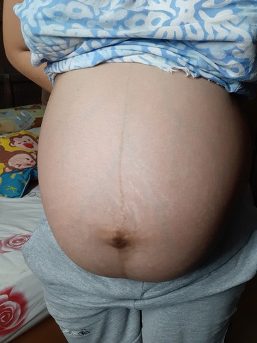35+5 week แบบนี้ ท้องลดยังคะ