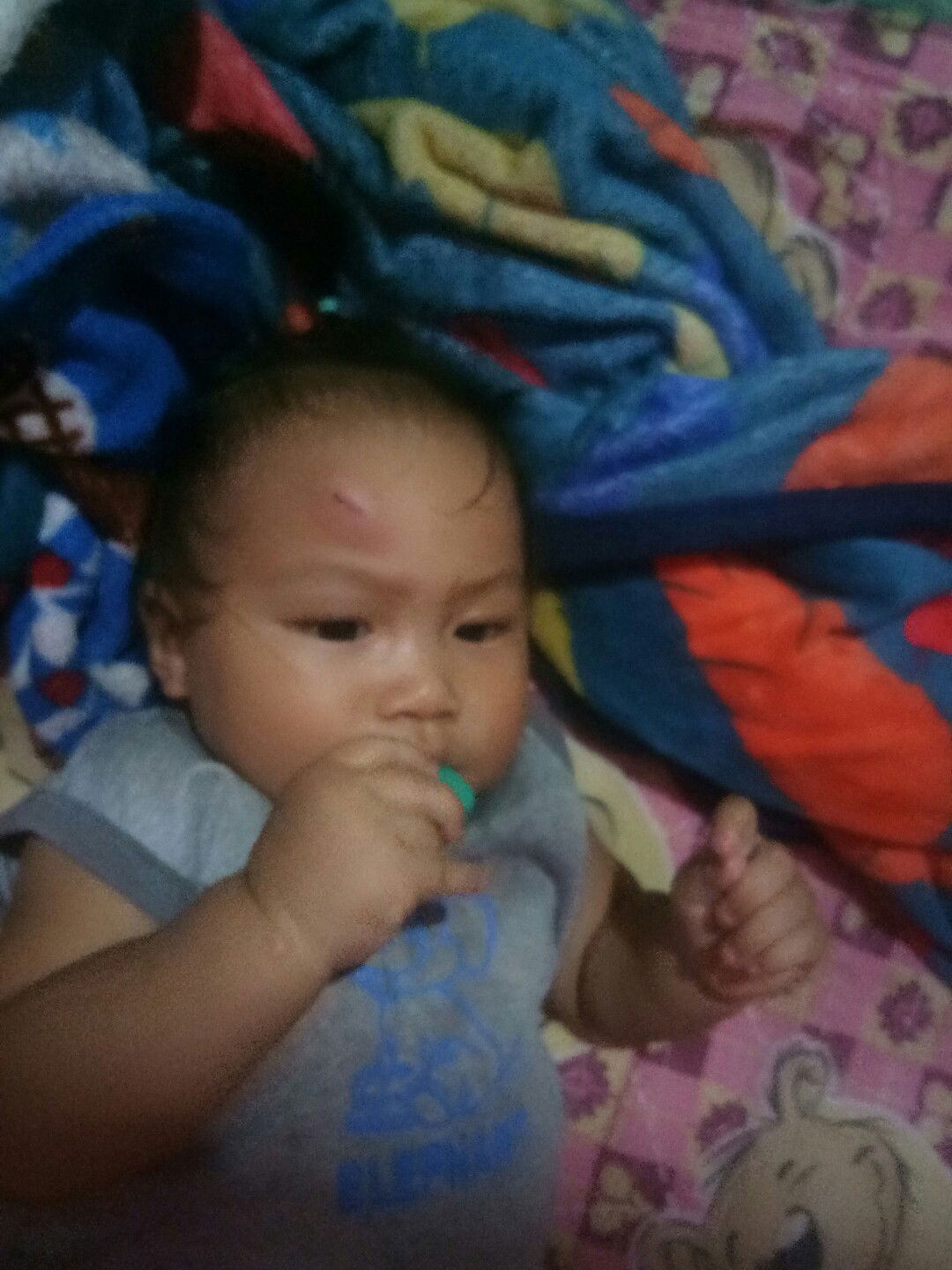 หวัดพึ่งหายหน้าผากแตกต่อจ้า...วัยหัดเดินนี่อันตรายมากจริงๆค่ะ