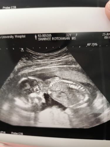 ลูกชอบนอนคว่ำ